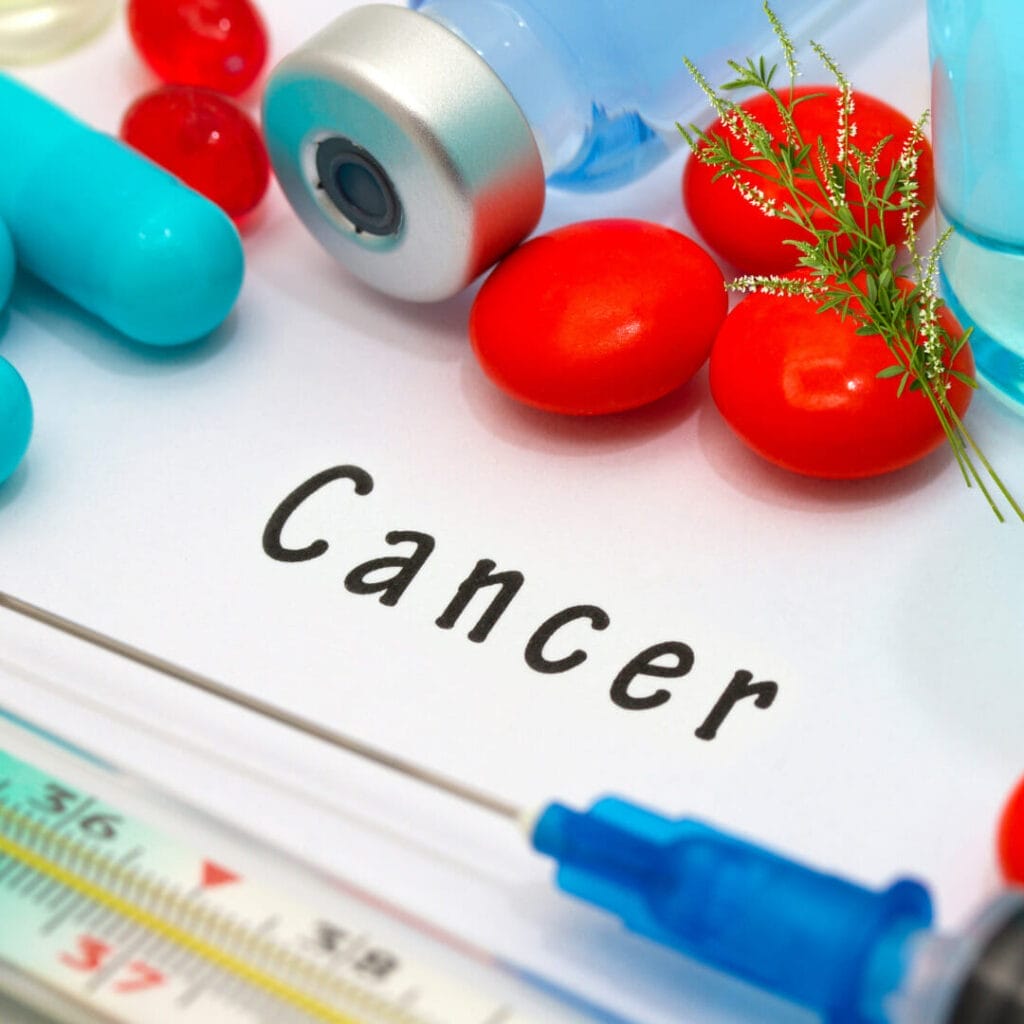 Cancer du Thymus et l'Âge : Tout ce que vous devez savoir 3